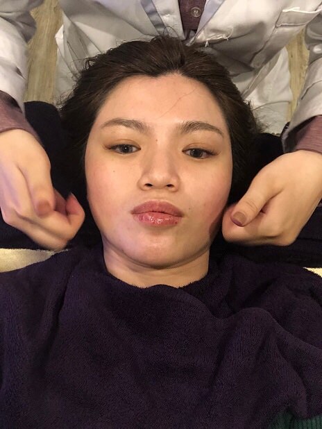 【台北大安｜醫美保養】Perfect Beauty｜體驗日本HIFU超音波拉提，臉部美顏緊緻V臉！