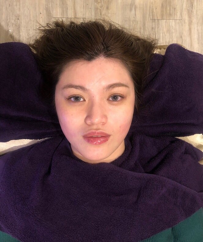 【台北大安｜醫美保養】Perfect Beauty｜體驗日本HIFU超音波拉提，臉部美顏緊緻V臉！