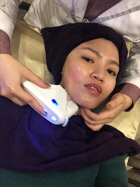 【台北大安｜醫美保養】Perfect Beauty｜體驗日本HIFU超音波拉提，臉部美顏緊緻V臉！