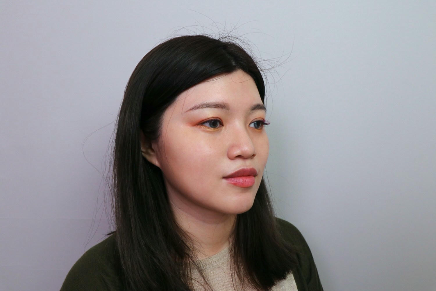 【台北大安區】佳思優整形醫美診所，皇家肉毒小臉全記錄，雕塑精緻下顎線❤️