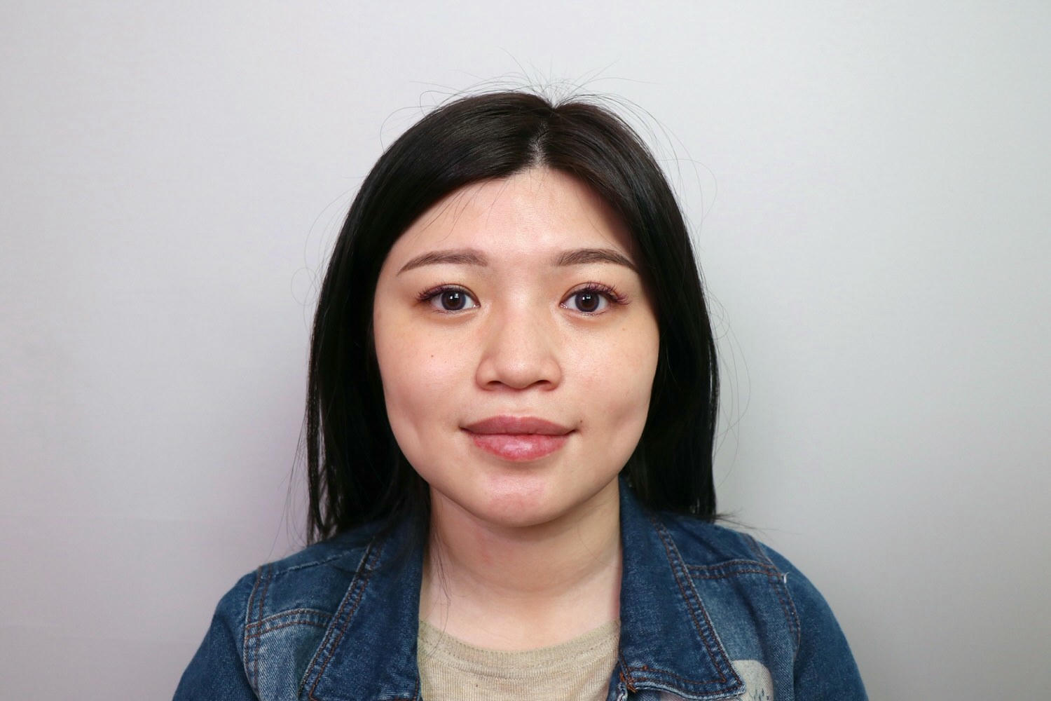 【台北大安區】佳思優整形醫美診所，皇家肉毒小臉全記錄，雕塑精緻下顎線❤️