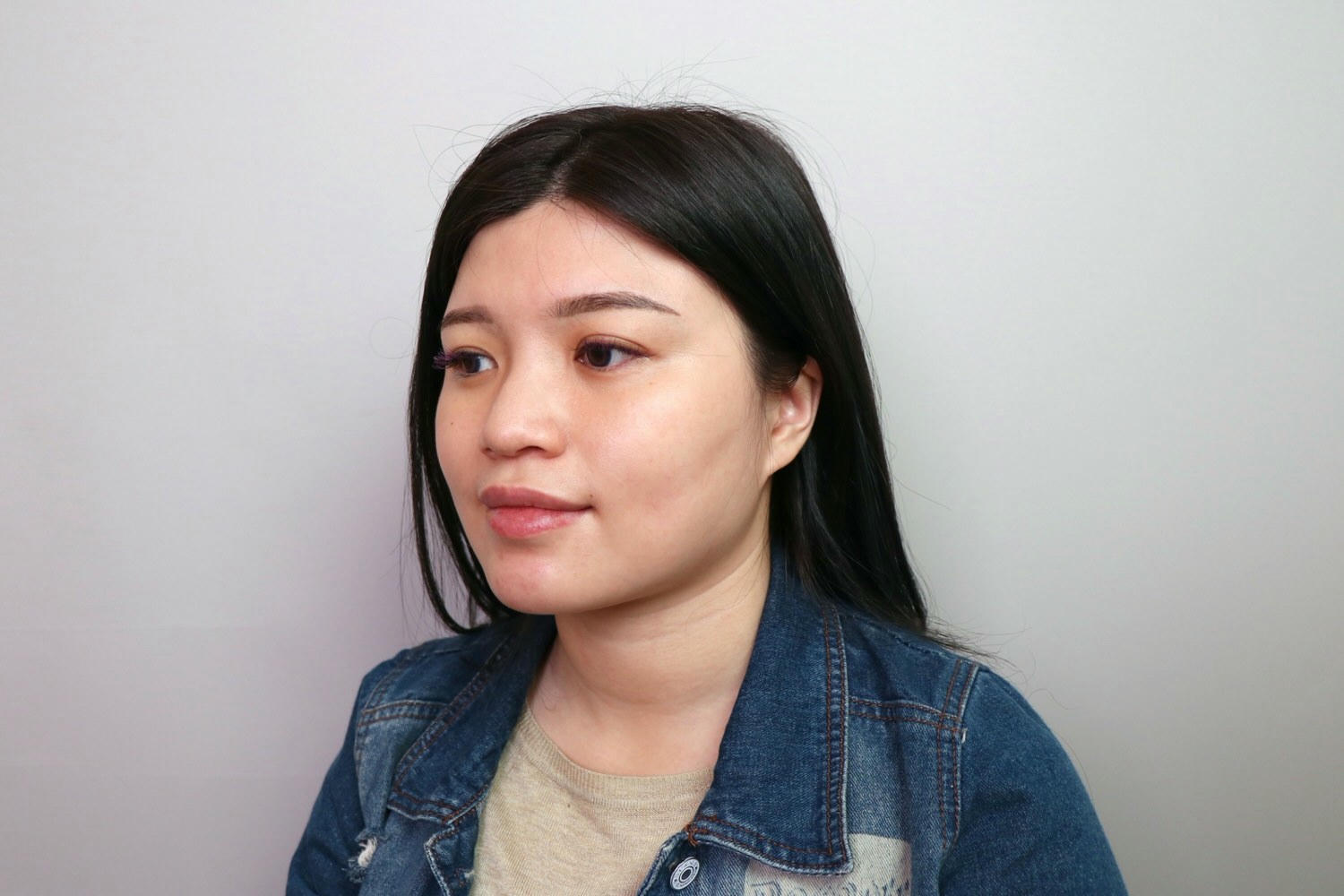 【台北大安區】佳思優整形醫美診所，皇家肉毒小臉全記錄，雕塑精緻下顎線❤️