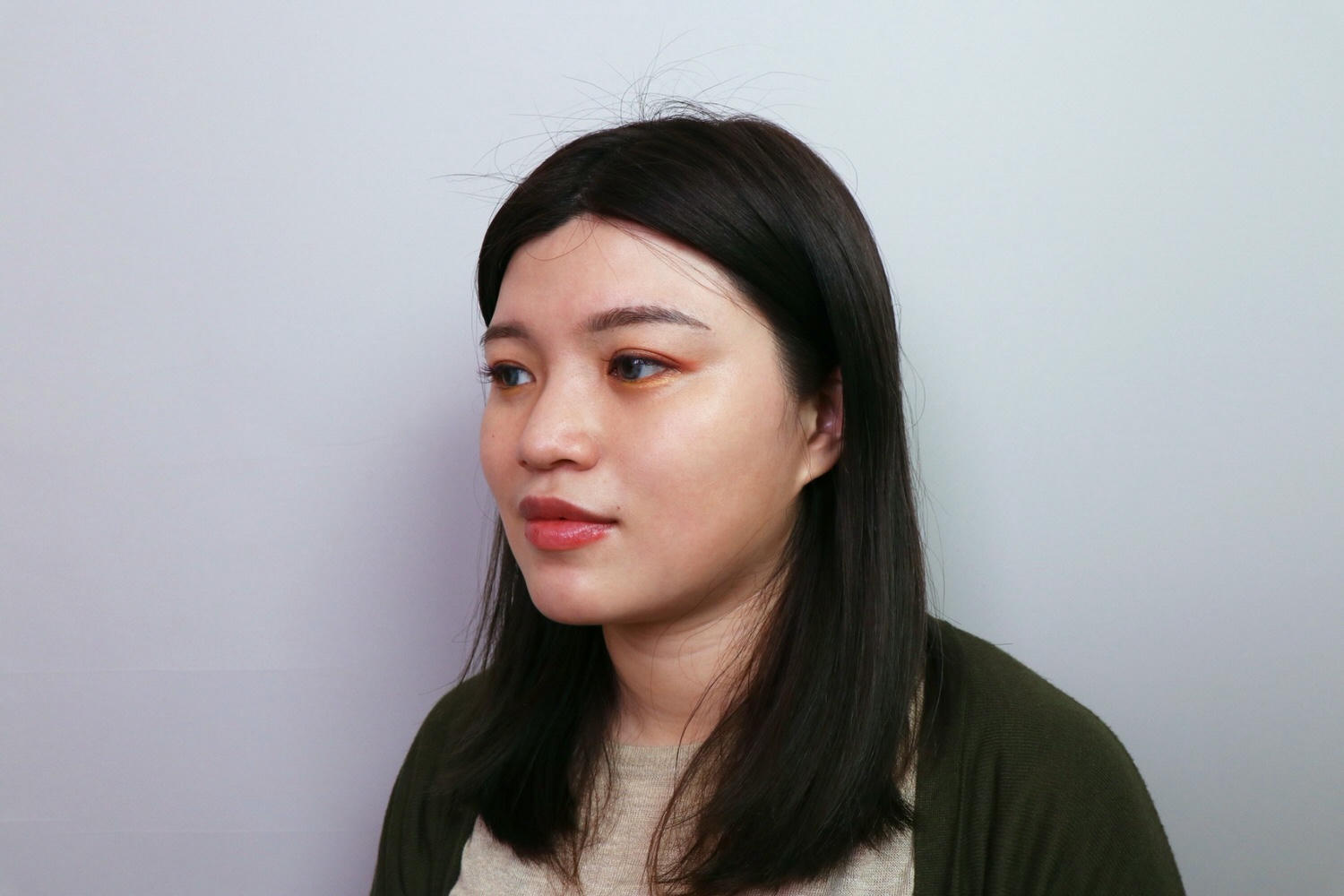【台北大安區】佳思優整形醫美診所，皇家肉毒小臉全記錄，雕塑精緻下顎線❤️