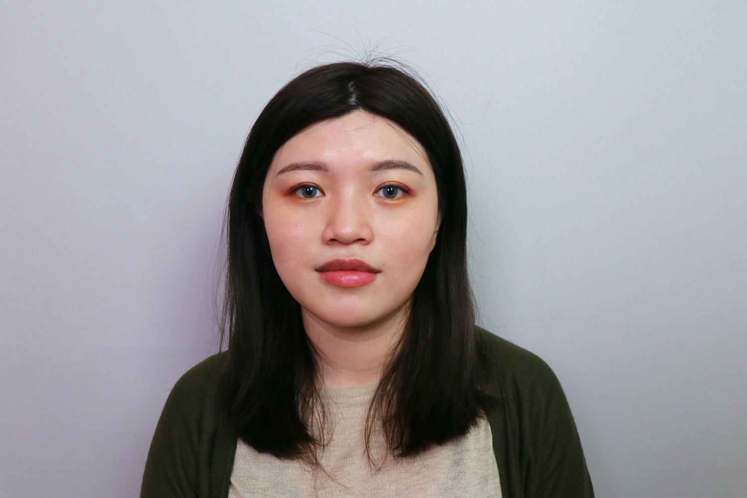 【台北大安區】佳思優整形醫美診所，皇家肉毒小臉全記錄，雕塑精緻下顎線❤️